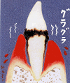grp1108103751.gif 100×119 8K grp1108103751.gif 100×119 8K