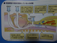 grp0529093110.jpg 200150 31K